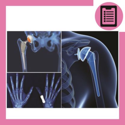 تصویر از آموزش استخوان و پروتزهای استخوانی