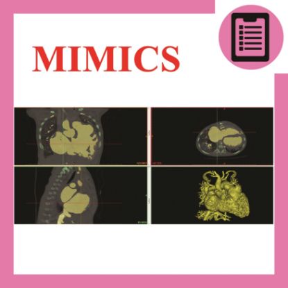 Picture of آموزش مدلسازی تصاویر سه بعدی مهندسی پزشکی با Mimics